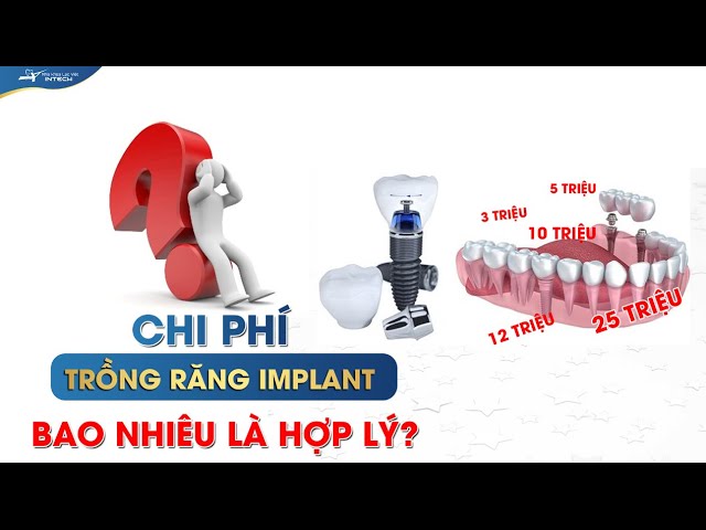 Chi phí trồng răng implant bao nhiêu? Tổng quan giá trồng răng implant tại Việt Nam