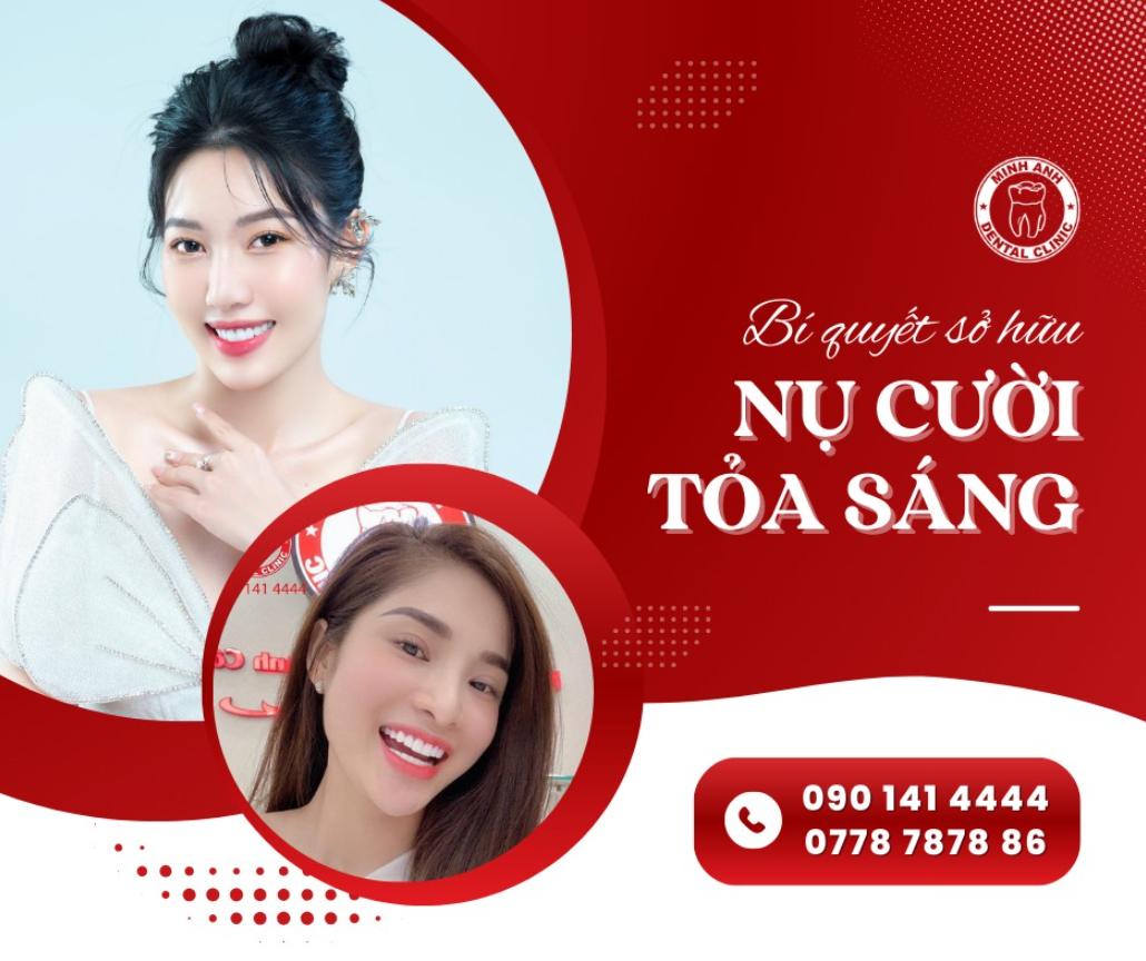 Phòng khám nha khoa Minh Anh