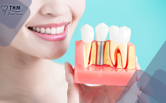 Trồng răng implant có đau không? Hướng dẫn chi tiết