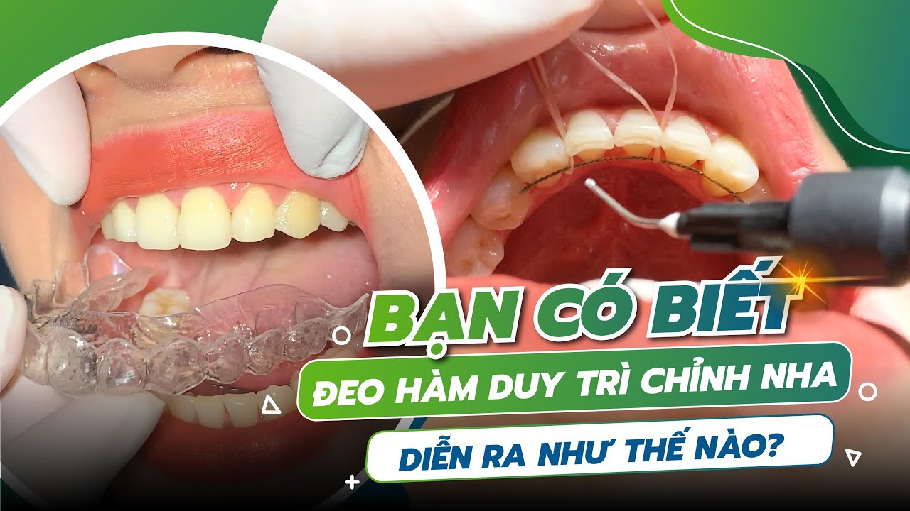 Hàm duy trì trong suốt là gì?