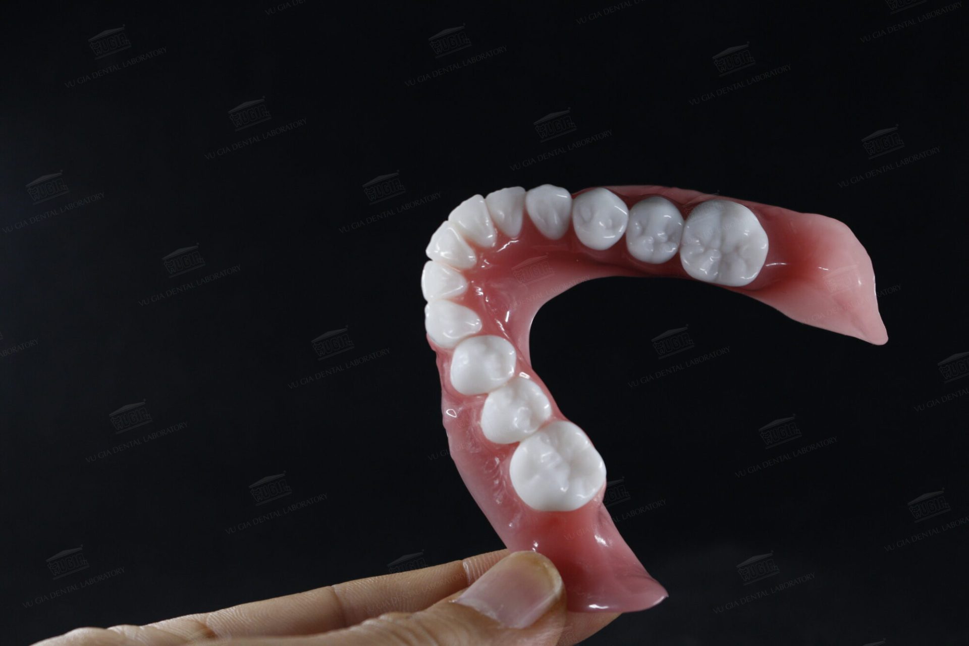 Hàm tháo lắp nhựa dẻo Phương pháp phục hình răng mất hiệu quả và tiết kiệm chi phí?