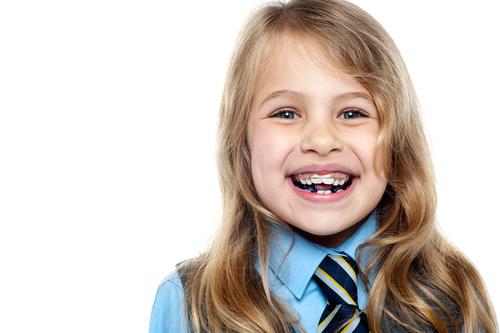 Niềng răng cho trẻ em Phương pháp, giá cả và địa điểm tốt nhất