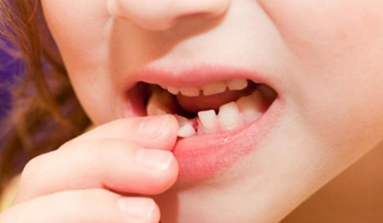 Quy trình thay răng của trẻ em từ 6 - 12 tuổi Hành trình đảm bảo hàm răng khỏe mạnh và đẹp