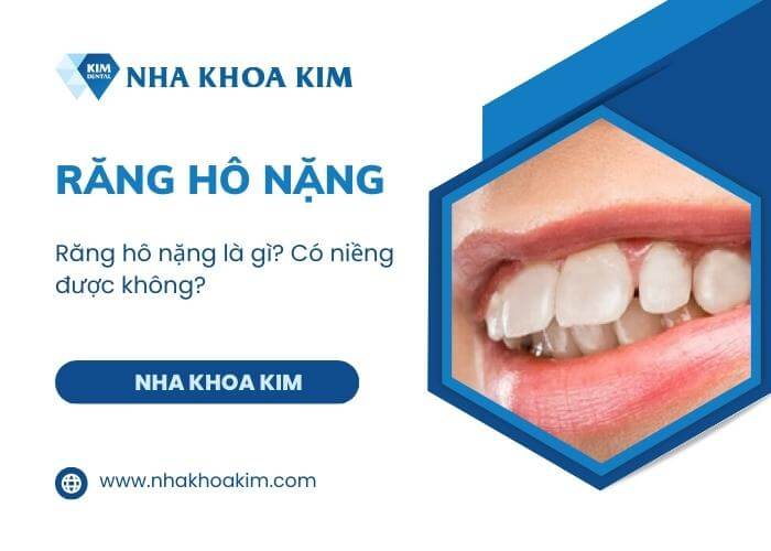 Răng hô vẩu Nguyên nhân là gì? Giải pháp nào dành cho răng vẩu?