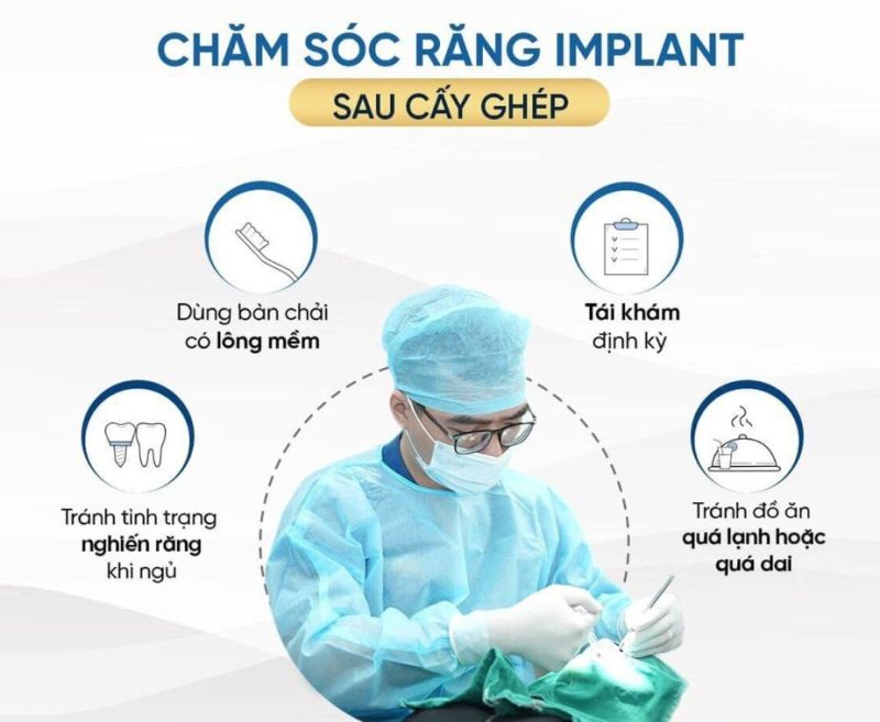  vệ sinh răng Implant