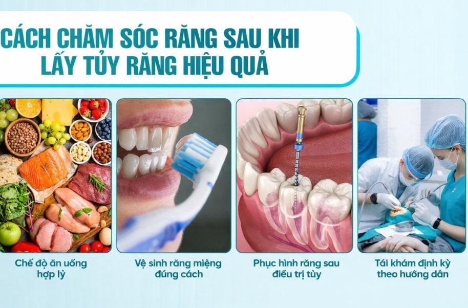 Chăm sóc răng kỹ lưỡng để hạn chế vi khuẩn và bảo vệ răng