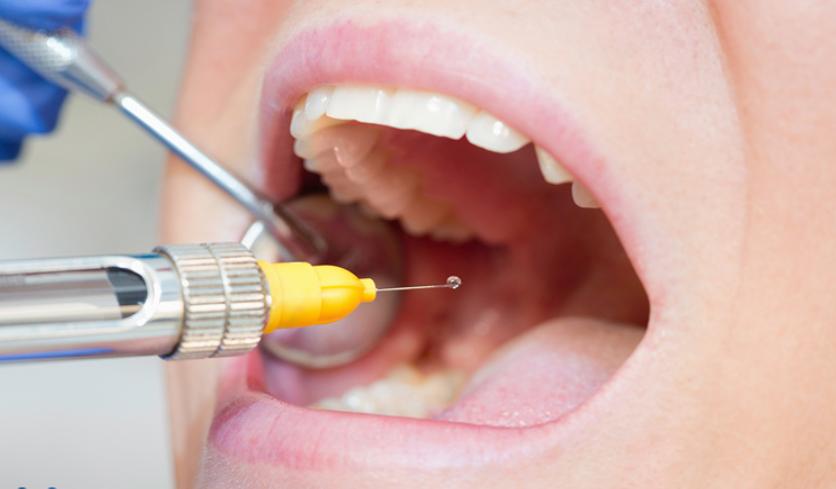 Gây tê giúp giảm cảm giác đau đớn trong quá trình lấy tủy