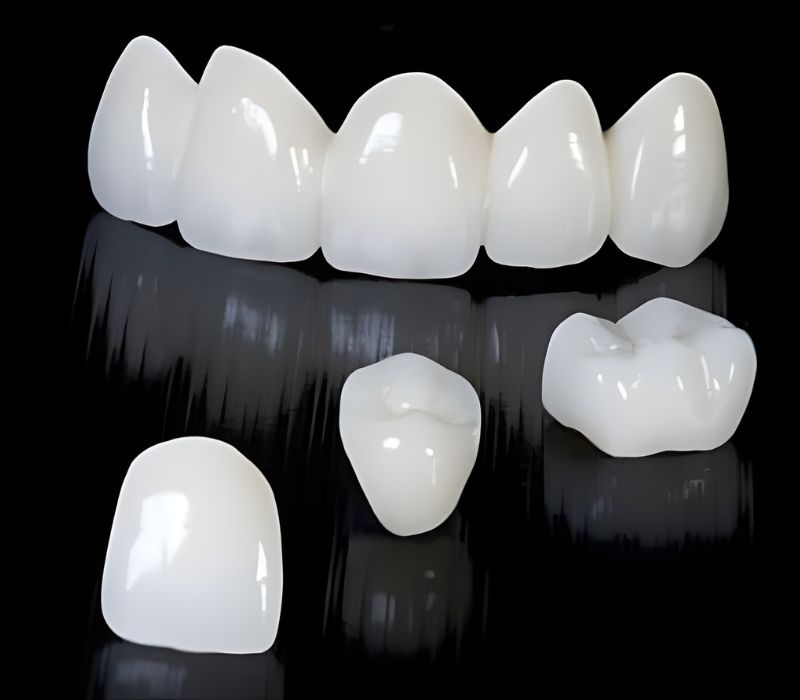 Răng sứ toàn sứ Emax