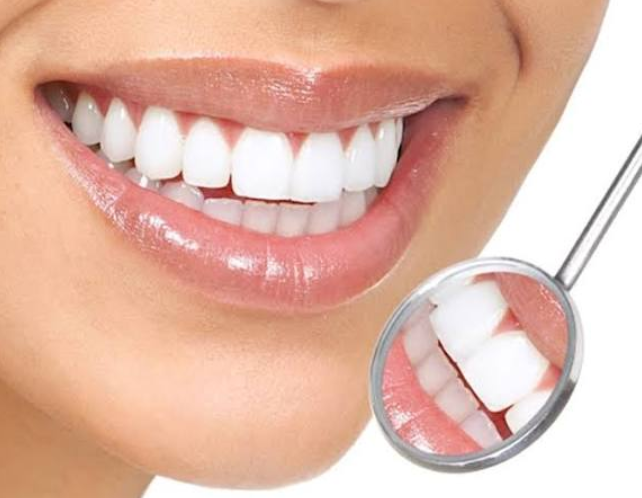 Cách chăm sóc giúp miếng trám răng cửa bền đẹp
